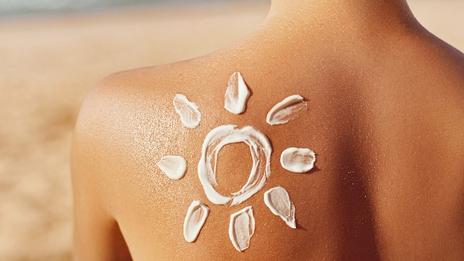 Plein feu sur les coups de soleil